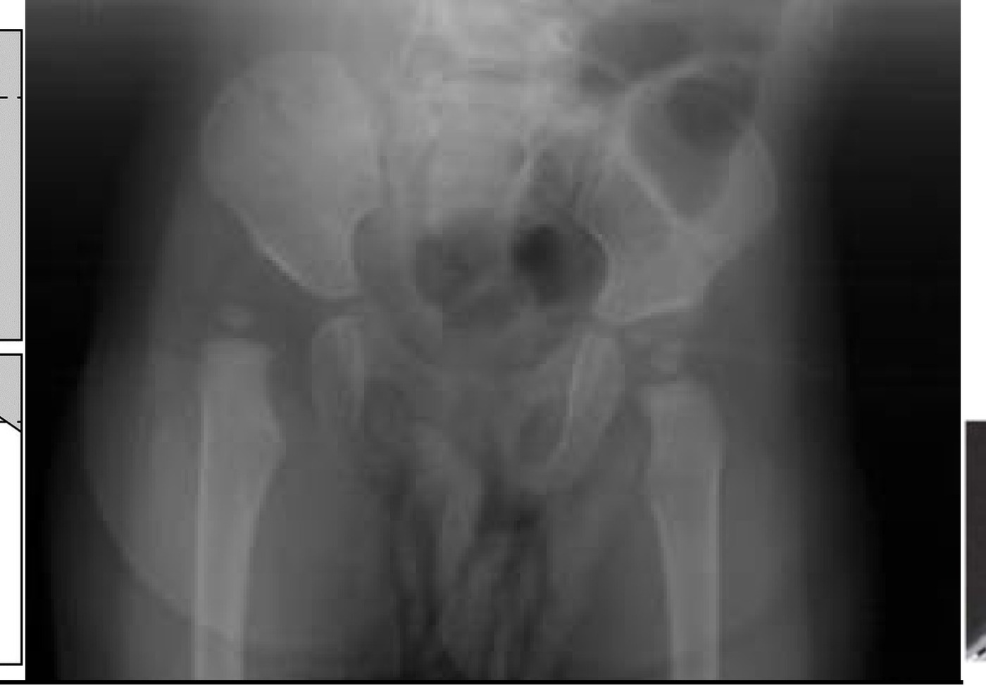 Radiograph / imaging - radiograph