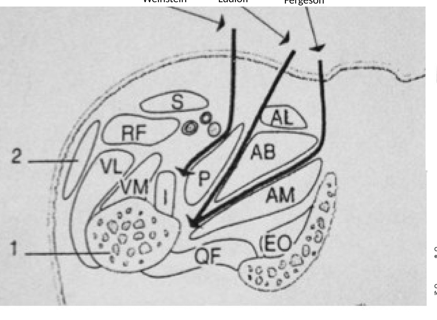 Operative / approach image - open reduction approach diagram