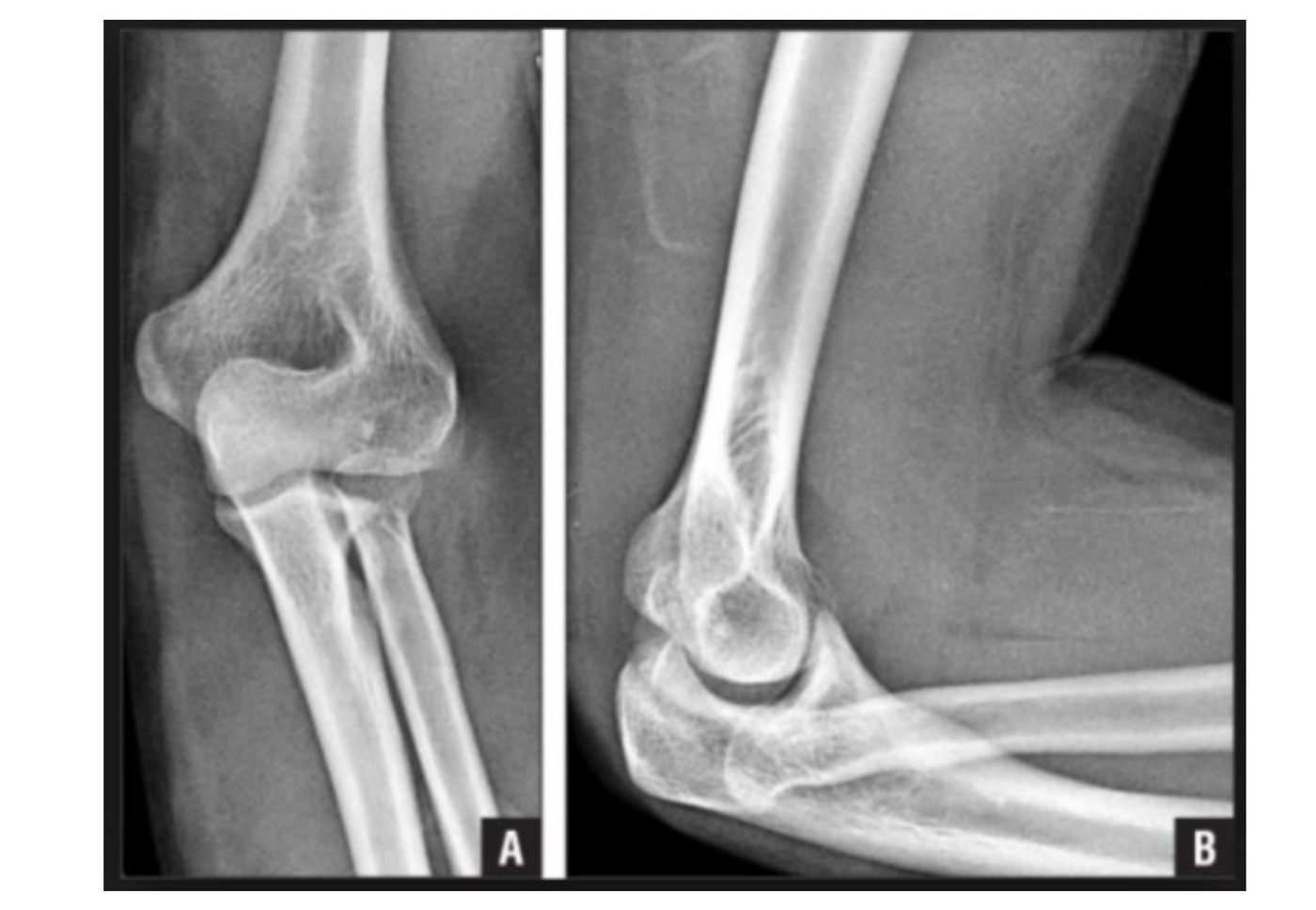 Radiograph / imaging