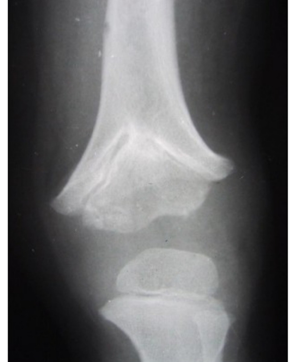 Radiograph / imaging