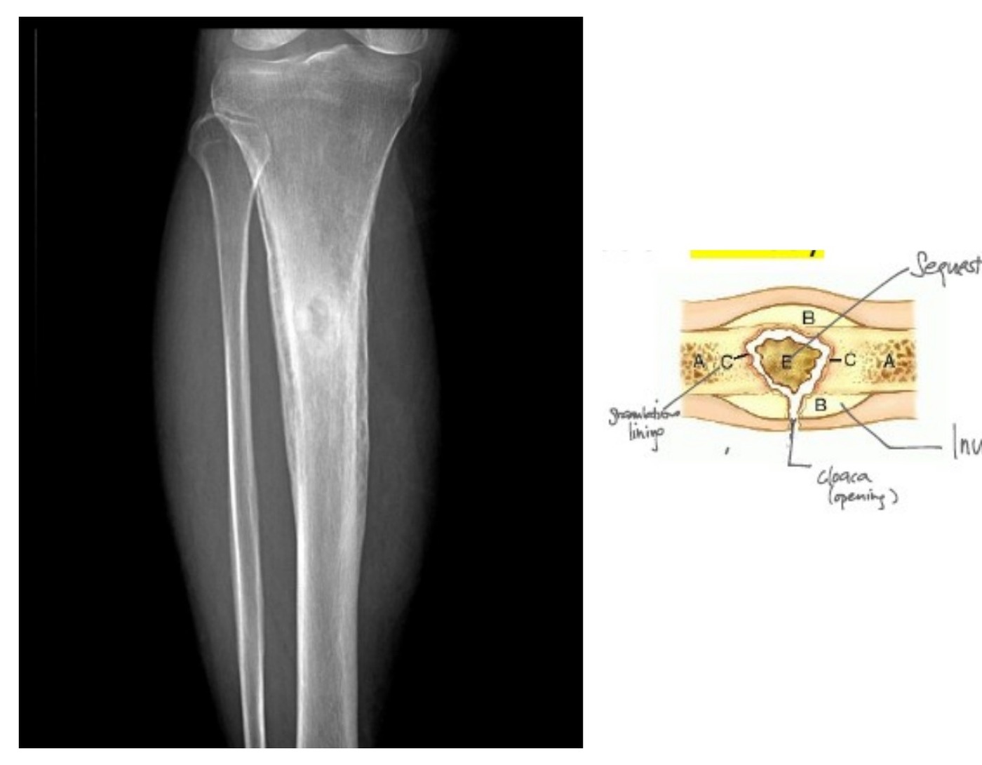 Radiograph / imaging
