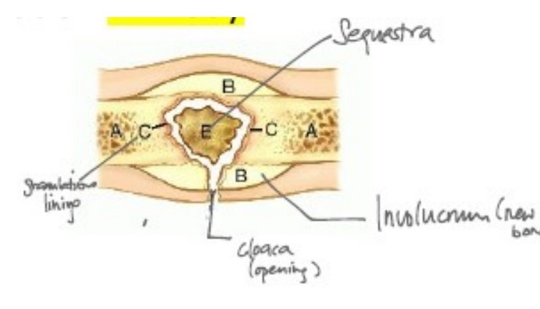 Radiograph / imaging