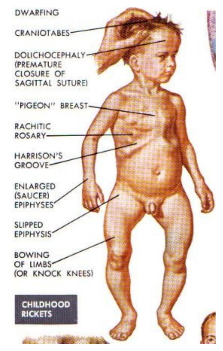 Slide figure