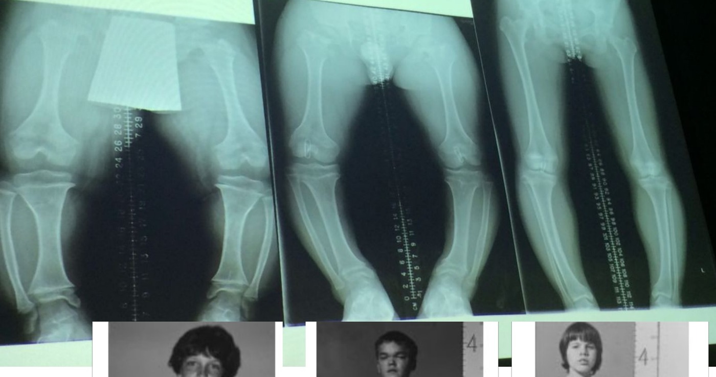 Operative / approach image