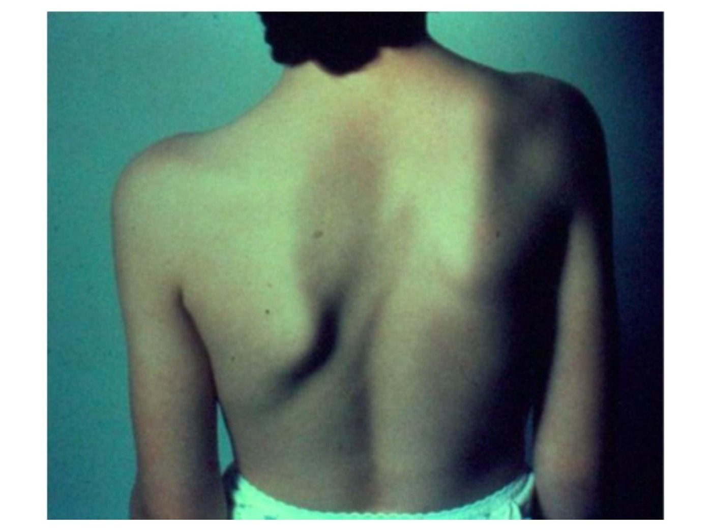 Clinical photograph