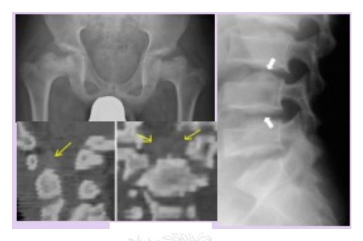 Radiograph / imaging