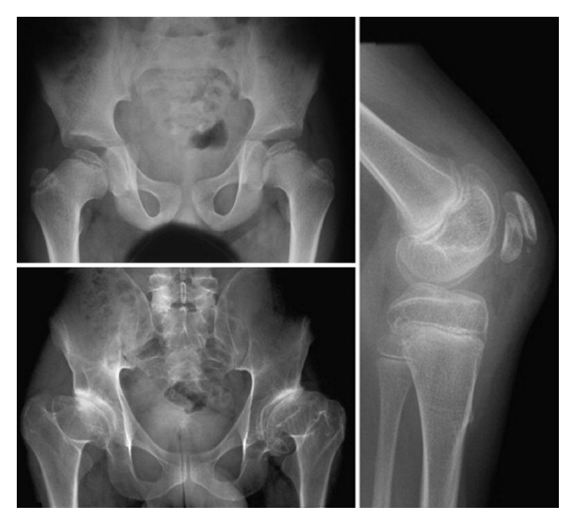 Radiograph / imaging