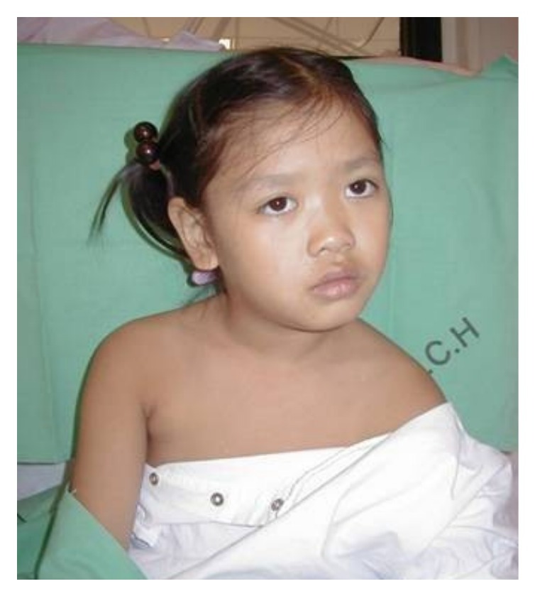 Clinical photograph