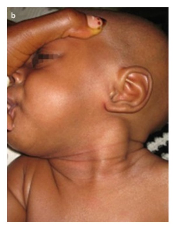 Clinical photograph