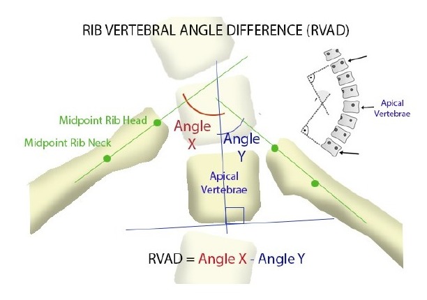 Clinical photograph