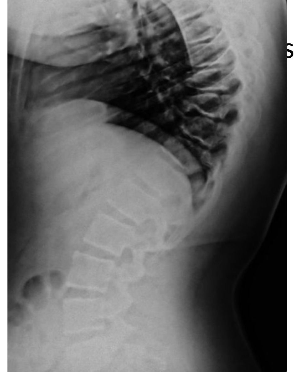 Radiograph / imaging