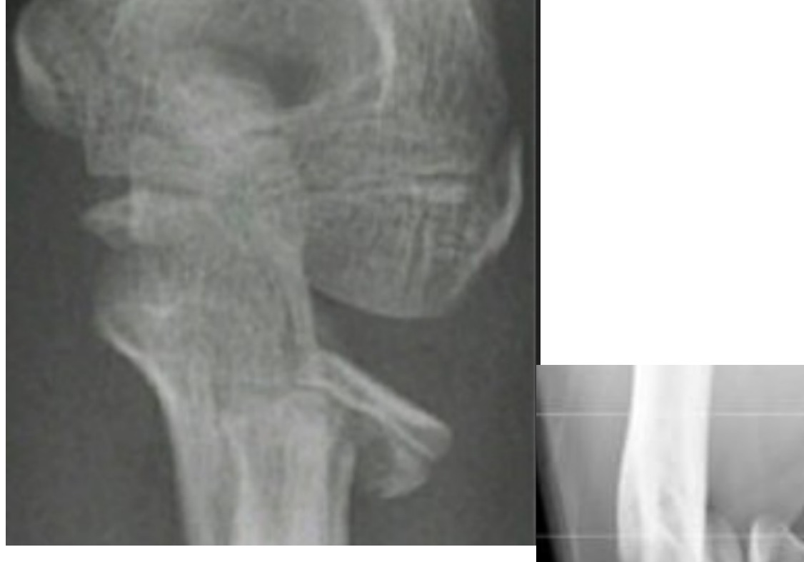 Radiograph / imaging