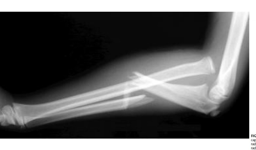 Radiograph / imaging