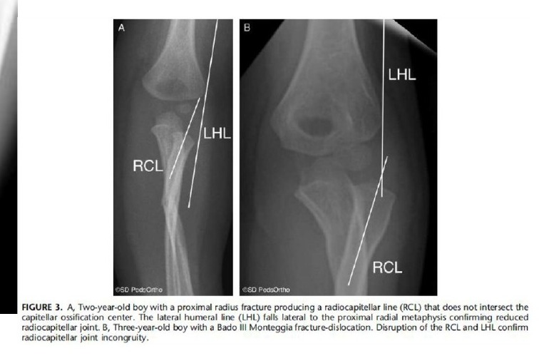 Radiograph / imaging