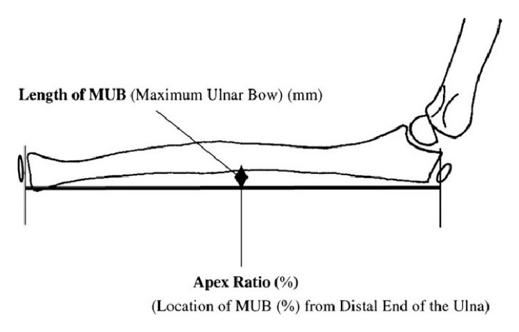 Classification / diagram - visible label: Bell tawse