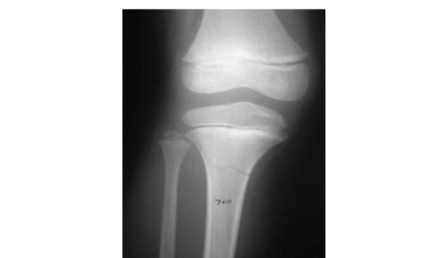 Radiograph / imaging