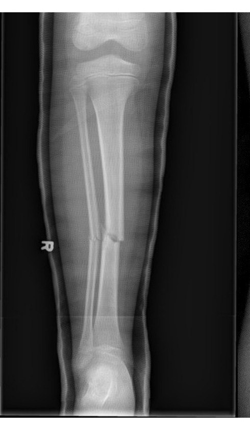 Radiograph / imaging