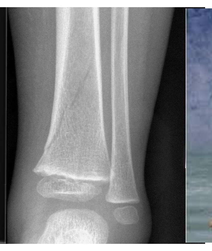 Radiograph / imaging
