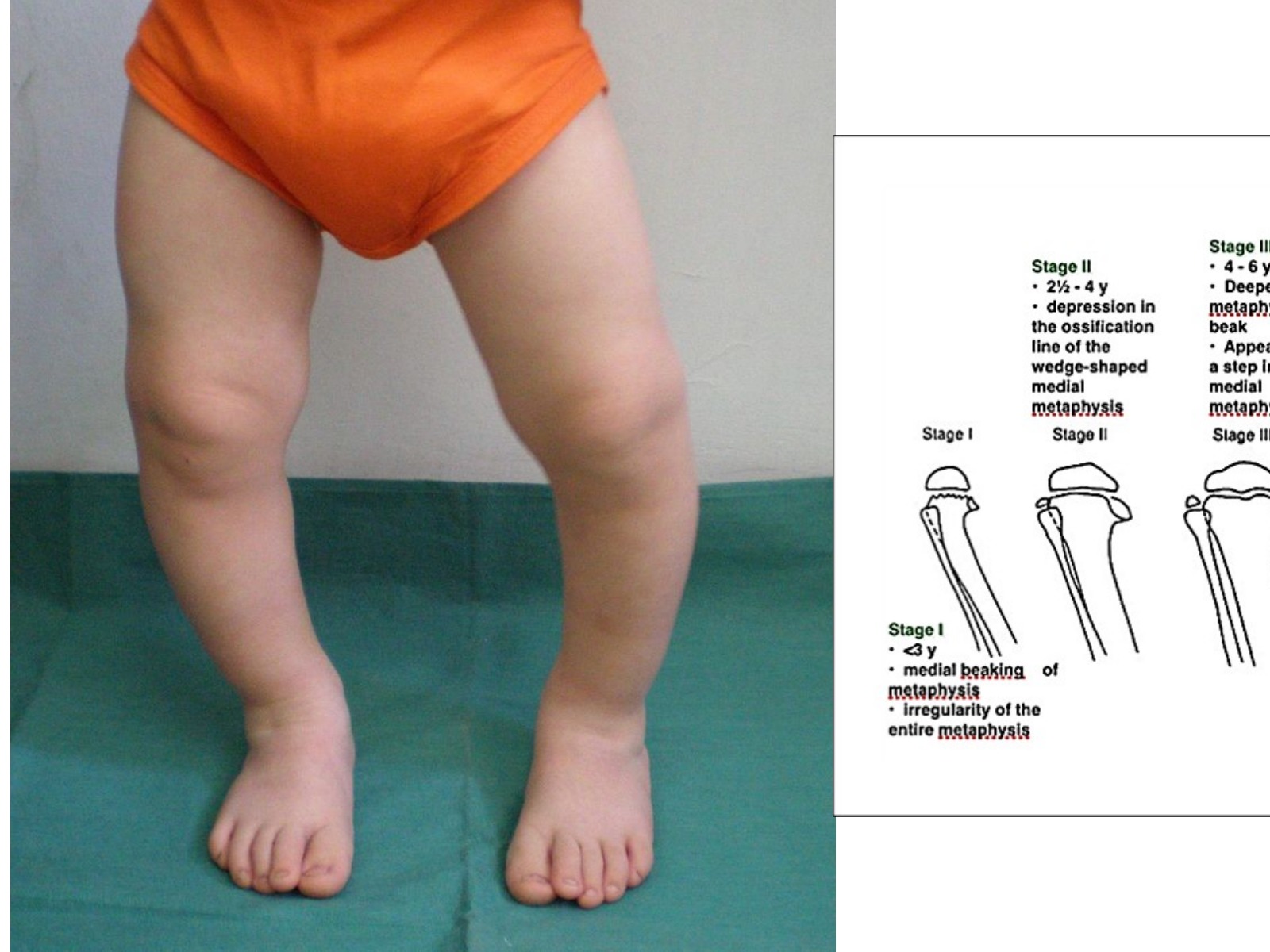 Slide 32 thumbnail