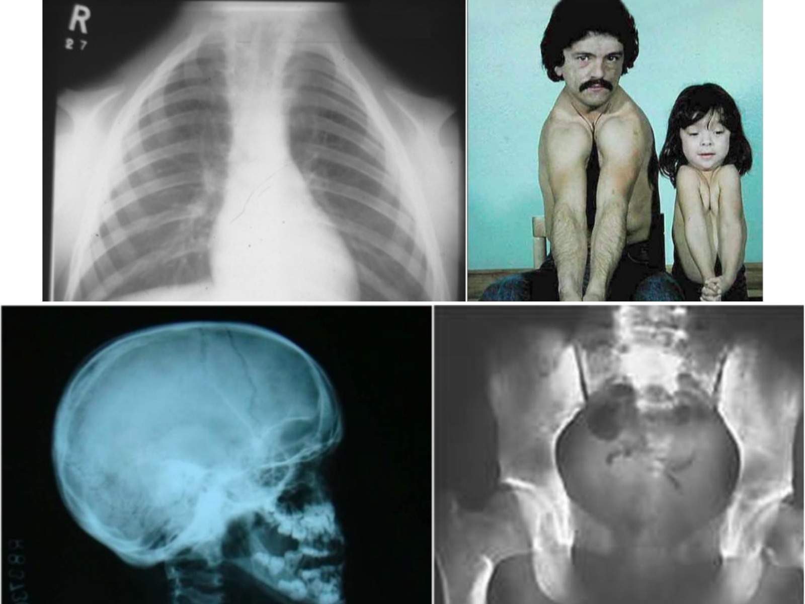 Slide 75 thumbnail