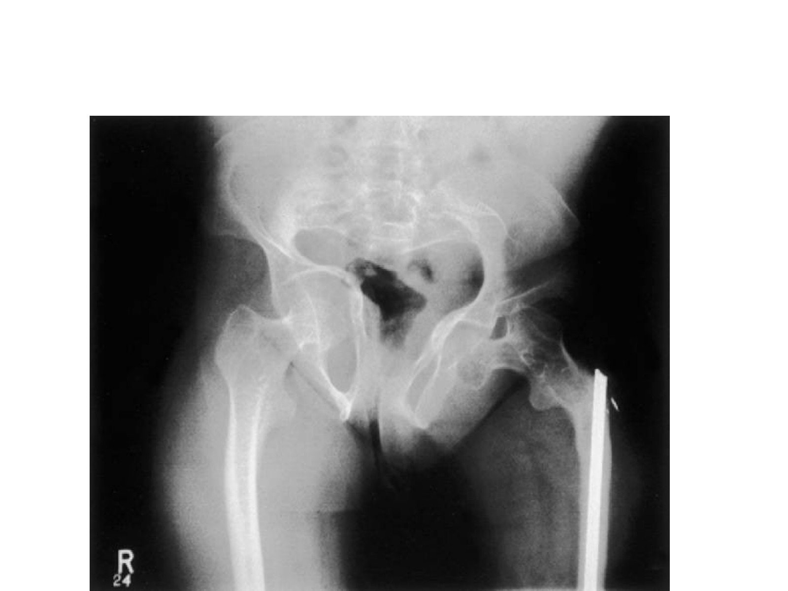 Slide 77 thumbnail