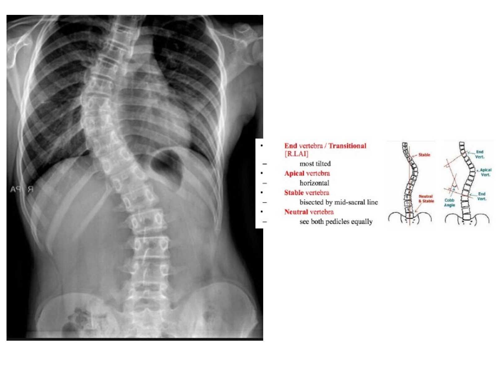Slide 84 thumbnail