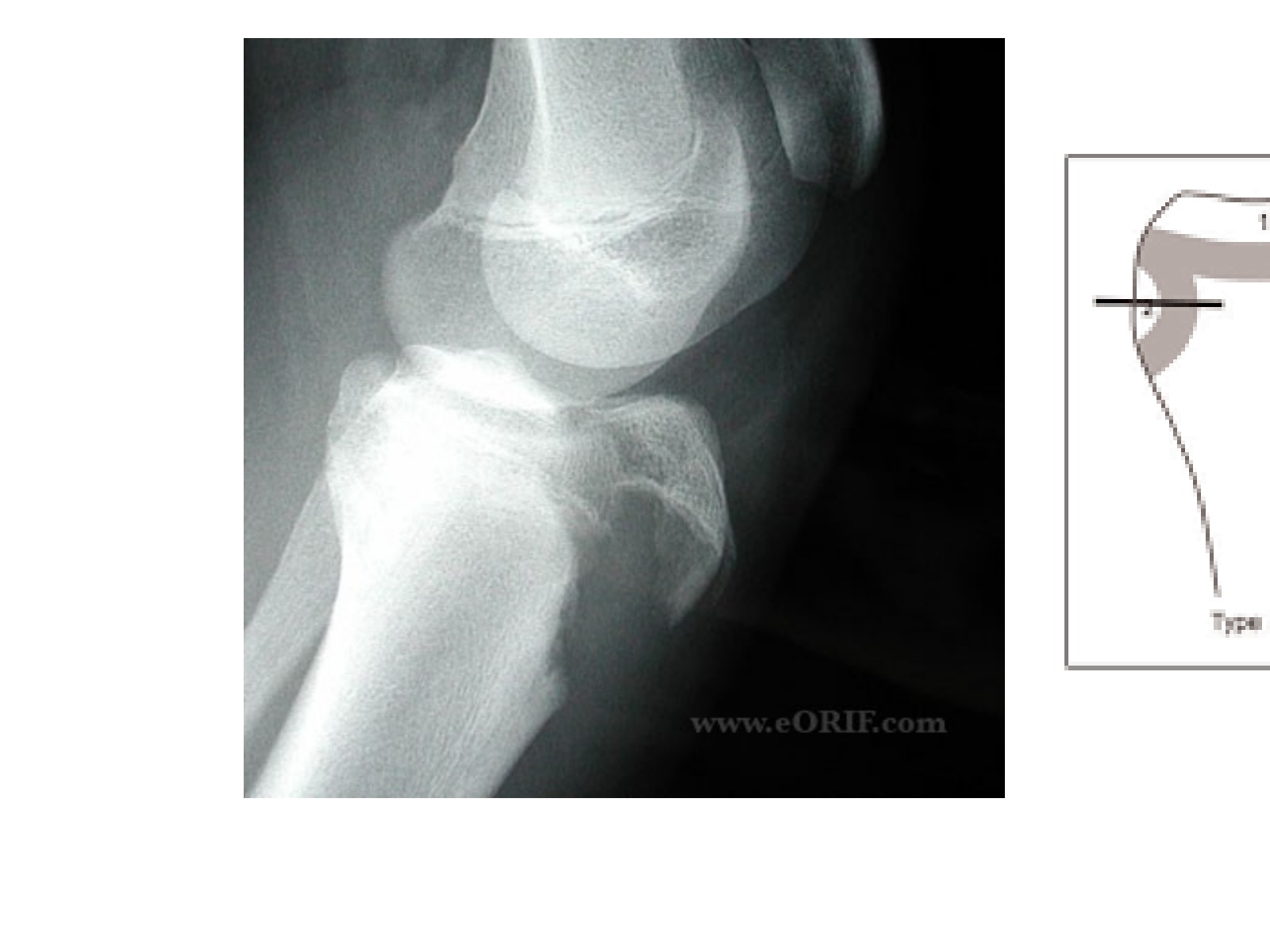 Slide 135 thumbnail